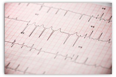 Stile di vita per fibrillazione atriale